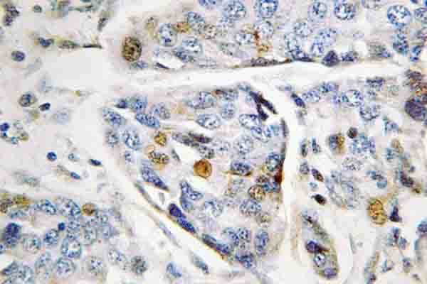 Polyclonal Rabbit anti-Human LMNA / Lamin A+C Antibody (Ser17, IHC, WB)