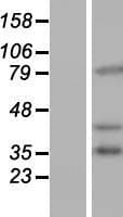 PCDHB16 Protein (Over-Expression Lysate Myc-DDK (Flag))