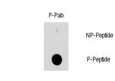 Polyclonal Rabbit anti-Human HSPB1 / HSP27 Antibody (phospho-Ser78)