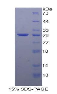 Human LIPC / Hepatic Lipase Protein (Recombinant His)