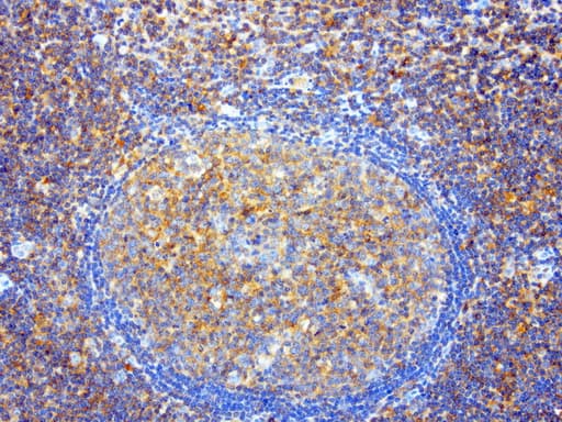 SDCBP / Syntenin Antibody (clone UMAB69)