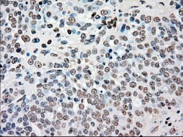 CHEK2 / CHK2 Antibody (clone OTI2H5)