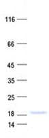 Human RPS15A Protein (Recombinant His, N-Terminal)