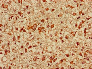 TOLLIP Antibody