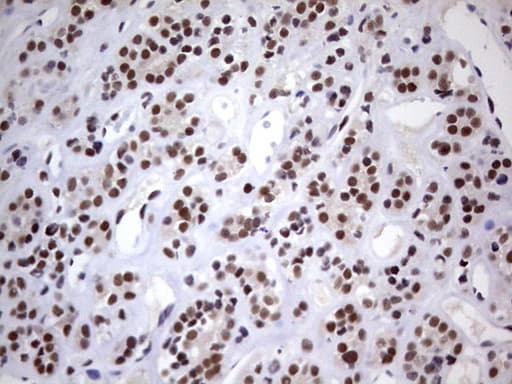Monoclonal Mouse anti-Human C14orf166 Antibody (clone OTI1G8, IHC, WB)