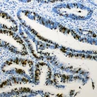 RB1 / Retinoblastoma / RB Antibody (C-Terminus)