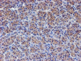 ERBB2 / HER2 Antibody (aa676-1255, clone OTI11A7, Carrier-free)