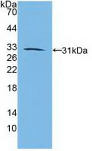 RARB / RAR Beta Antibody (aa205-451)