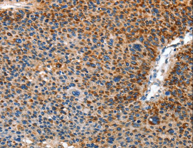 Polyclonal Rabbit anti-Human AMDHD2 Antibody (IHC, WB)