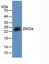 Mouse IL2 Protein (Recombinant His, N-Terminal)