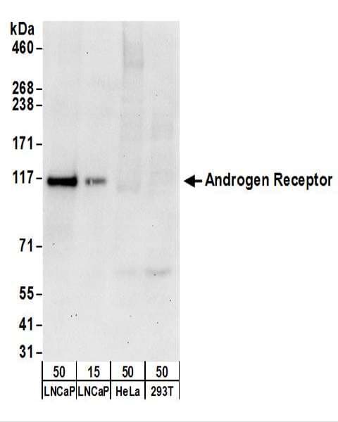 AR / Androgen Receptor Antibody (aa1-50)