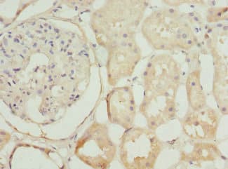 NEK3 Antibody