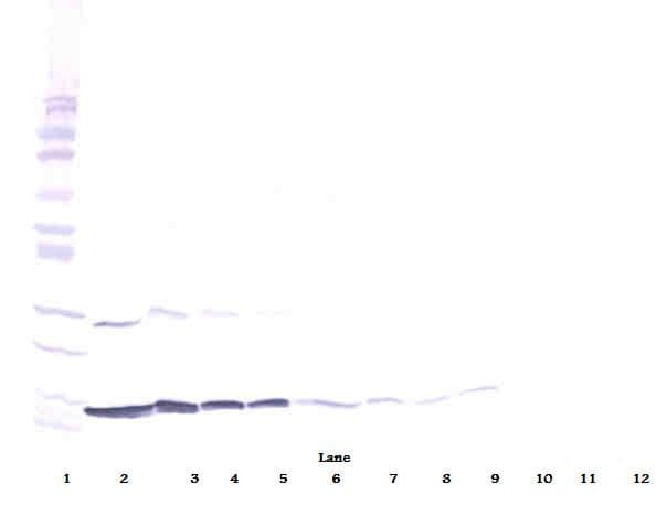 IFN Gamma / Interferon Gamma Antibody (Biotin)