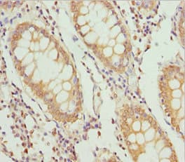 Polyclonal Rabbit anti-Human PLEKHA1 Antibody (IHC)