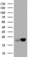 NME1 / NM23 Antibody (clone OTI22F10)