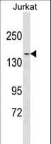 MYH9 Antibody (aa1840-1867)