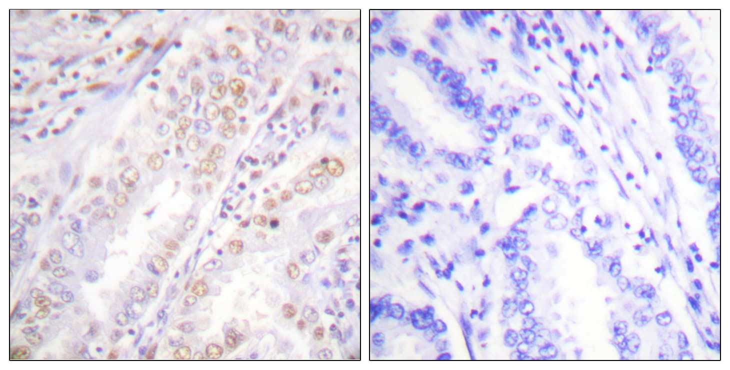 Polyclonal Rabbit anti-Human XRCC2 Antibody (aa211-260, IHC)