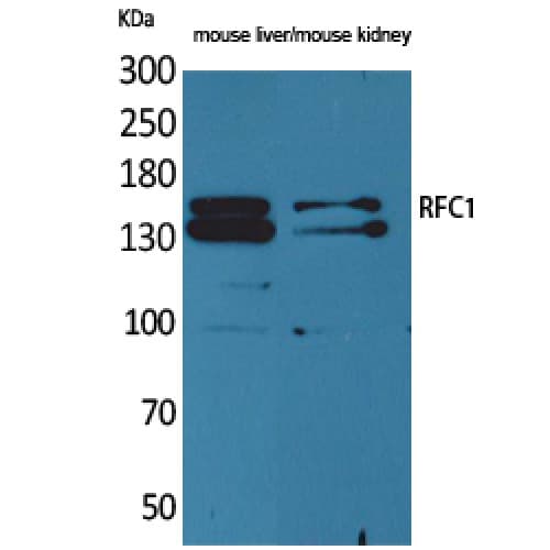 RFC1 / RFC Antibody (Internal)