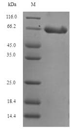 Human DCX / Doublecortin Protein (Recombinant 6His-SUMO, N-terminus)