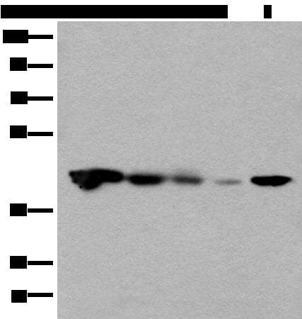 CECR5 Antibody