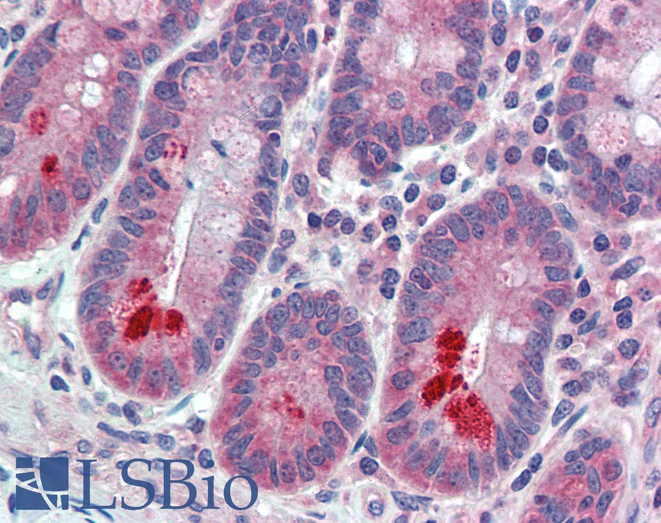 IHC-plus™ ESYT1 Antibody (Internal)