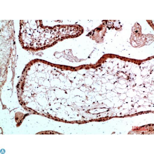 Polyclonal Rabbit anti-Human Ubiquitin Antibody (IHC)