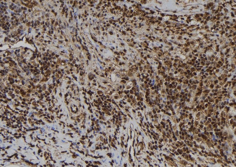 AIMP1 / EMAP II Antibody
