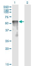 SESN2 / HI95 Antibody (clone 3B8)
