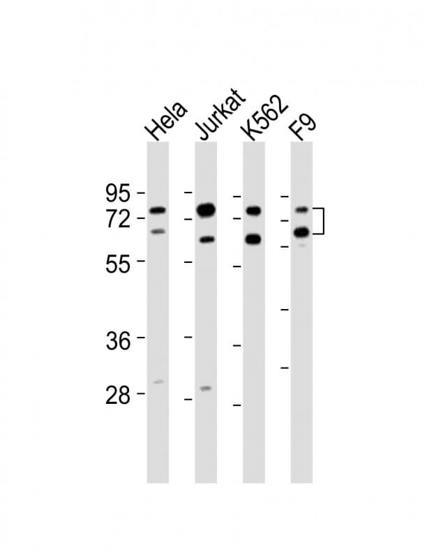 Polyclonal Rabbit anti-Human ASH2L / ASH2 Antibody (aa347-382, WB)