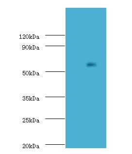 ADCK2 Antibody