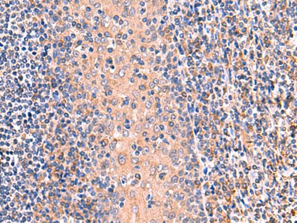 OSBPL2 Antibody