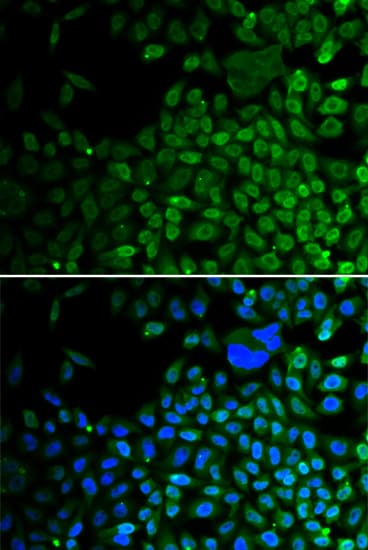 Polyclonal Rabbit anti-Human HDAC2 Antibody (IHC, IF, WB)