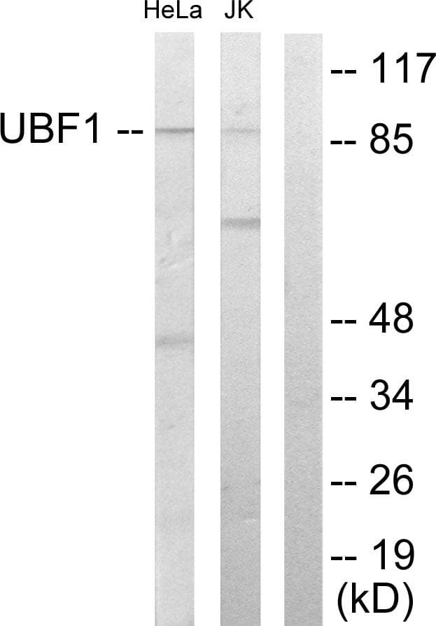 UBTF / UBF Antibody