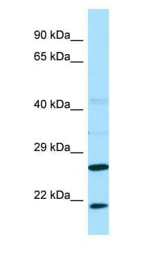 VBP1 Antibody (C-Terminus)