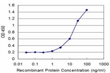 RNF2 / RING2 / RING1B Antibody (clone 2B6)