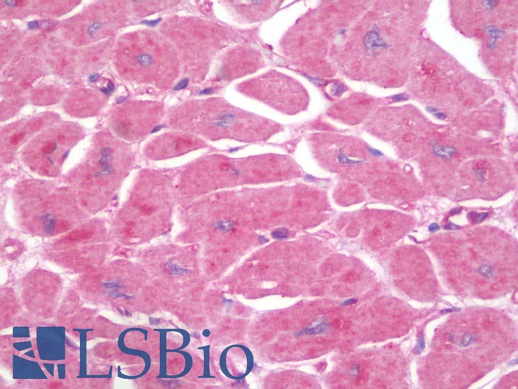IHC-plus™ Polyclonal Rabbit anti-Human CD59 Antibody (aa29-102, IHC)