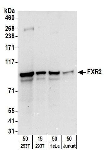 Polyclonal Rabbit anti-Human UBXD7 Antibody (aa439-489, WB)