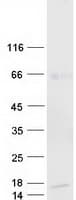 Human AMY1B Protein (Recombinant Myc-DDK (Flag))