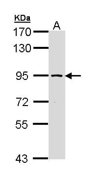 Polyclonal Rabbit anti-Human FACT / SSRP1 Antibody (aa75-338, IHC, WB)