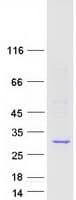 Human CAPNS1 / CAPN4 Protein (Recombinant Myc-DDK (Flag))