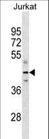 FH / Fumarase / MCL Antibody (aa35-63)
