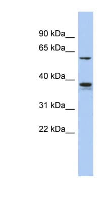 Polyclonal Rabbit anti-Human GOPC / PIST Antibody (aa251-300, WB)