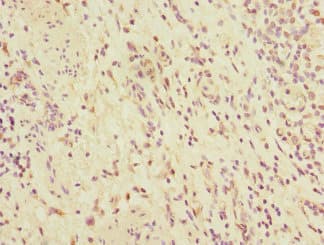 MMP19 Antibody