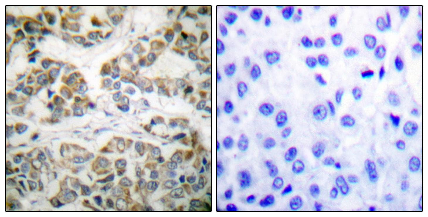 Polyclonal Rabbit anti-Human p66 / SHC Antibody (phospho-Tyr349, IHC, WB)