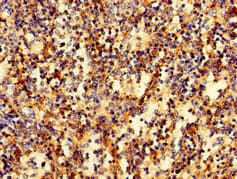 RAB27A / RAB27 Antibody