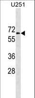 GGT1 / GGT Antibody (aa124-152)