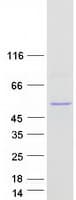 Human UGT2B10 Protein (Recombinant Myc-DDK (Flag))