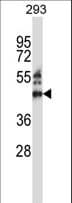 ZNF660 Antibody (aa303-331)