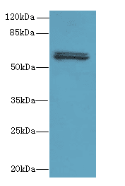 FAM222B Antibody