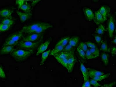MAN2A1 / Mannosidase II Antibody